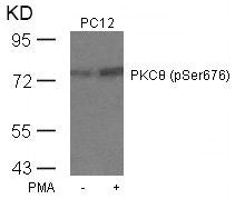 Western blot analysis of extracts from PC12 cells untreated or treated with PMA using PKCth(Phospho-Ser676) Antibody.