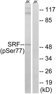 Western blot analysis of extracts from Jurkat cells, treated with PMA (125ng/ml, 30mins), using SRF (Phospho-Ser77) antibody. The lane on the right is treated with the synthesized peptide.