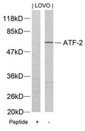Western blot analysis of extracts from LOVO cells using ATF2(Ab-73 or 55) Antibody and the same antibody preincubated with blocking peptide.