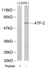 Western blot analysis of extracts from LOVO cells using ATF2(Ab-73 or 55) Antibody and the same antibody preincubated with blocking peptide.
