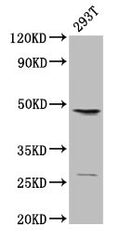Western Blot
Positive WB detected in: 293T whole cell lysate
All lanes: VEGFC antibody at 2µg/ml
Secondary
Goat polyclonal to rabbit IgG at 1/15000 dilution
Predicted band size: 47 kDa
Observed band size: 47 kDa