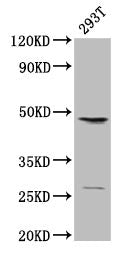 Western Blot
Positive WB detected in: 293T whole cell lysate
All lanes: VEGFC antibody at 2µg/ml
Secondary
Goat polyclonal to rabbit IgG at 1/15000 dilution
Predicted band size: 47 kDa
Observed band size: 47 kDa