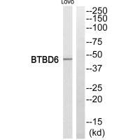 Western blot analysis of extracts from LOVO cells, using BTBD6 antiobdy.