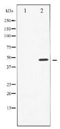 Western blot analysis of Cyclin E1 expression in Paclitaxel treated HeLa whole cell lysates, The lane on the left is treated with the antigen-specific peptide.