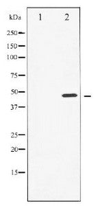 Western blot analysis of Cyclin E1 expression in Paclitaxel treated HeLa whole cell lysates, The lane on the left is treated with the antigen-specific peptide.