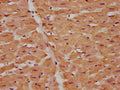 IHC image of CSB-PA07554A0Rb diluted at 1:225 and staining in paraffin-embedded human heart tissue performed on a Leica BondTM system. After dewaxing and hydration, antigen retrieval was mediated by high pressure in a citrate buffer (pH 6.0). Section was blocked with 10% normal goat serum 30min at RT. Then primary antibody (1% BSA) was incubated at 4&deg;C overnight. The primary is detected by a biotinylated secondary antibody and visualized using an HRP conjugated SP system.
