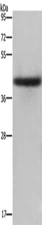 Gel: 8%SDS-PAGE, Lysate: 40 ug, Lane: Human placenta tissue, Primary antibody: CSB-PA075804(EPSTI1 Antibody) at dilution 1/2000, Secondary antibody: Goat anti rabbit IgG at 1/8000 dilution, Exposure time: 2 minutes