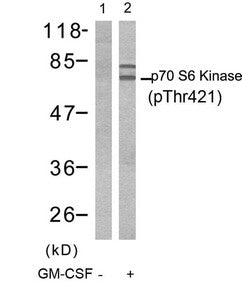 Western blot analysis of extracts from Jurkat cells untreated(lane 1) or treated with GM-CSF(lane 2) using p70 S6 Kinase(Phospho-Thr421) Antibody.