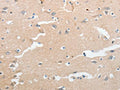 The image on the left is immunohistochemistry of paraffin-embedded Human brain tissue using CSB-PA076130(LCN2 Antibody) at dilution 1/50, on the right is treated with synthetic peptide. (Original magnification: ×200)