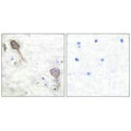 Immunohistochemical analysis of paraffin-embedded human brain tissue using Parkin antibody.
