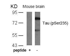 Western blot analysis of extracts from mouse brain tissue using Tau(Phospho-Ser235) Antibody and the same antibody preincubated with blocking peptide.