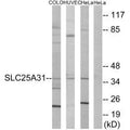 Western blot analysis of extracts from COLO cells, HUVEC cells and HeLa cells, using SLC25A31 antibody.