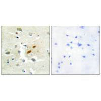 Immunohistochemistry analysis of paraffin-embedded human brain tissue, using DNA Polymerase ζ antibody.
