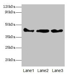 Western blot
All lanes: Actb antibody at 2µg/ml
Lane 1: Mouse spleen tissue
Lane 2: 293T whole cell lysate
Lane 3: Hela whole cell lysate
Secondary
Goat polyclonal to rabbit IgG at 1/10000 dilution
Predicted band size: 42 kDa
Observed band size: 42 kDa