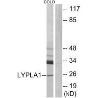 Western blot analysis of extracts from COLO cells, using LYPLA1 antibody.