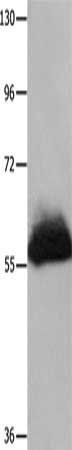 Gel: 10%SDS-PAGE, Lysate: 60 ug, Lane: Human transitional cell carcinoma tissue, Primary antibody: CSB-PA077368(HPSE Antibody) at dilution 1/100, Secondary antibody: Goat anti rabbit IgG at 1/8000 dilution, Exposure time: 5 minutes