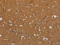 The image on the left is immunohistochemistry of paraffin-embedded Human brain tissue using CSB-PA077659(CSH1 Antibody) at dilution 1/40, on the right is treated with fusion protein. (Original magnification: ×200)