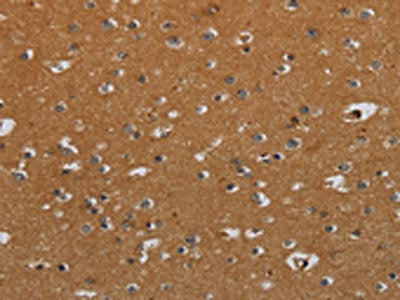 The image on the left is immunohistochemistry of paraffin-embedded Human brain tissue using CSB-PA077659(CSH1 Antibody) at dilution 1/40, on the right is treated with fusion protein. (Original magnification: ×200)