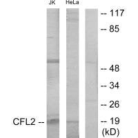 Western blot analysis of extracts from Jurkat cells and HeLa cells, using Cofilin antibody.