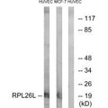 Western blot analysis of extracts from HUVEC cells and MCF-7 cells, using RPL26L antibody.