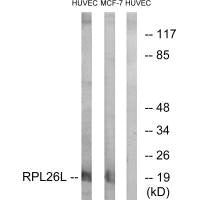 Western blot analysis of extracts from HUVEC cells and MCF-7 cells, using RPL26L antibody.