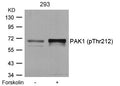Western blot analysis of extracts from 293 cells untreated or treated with forskolin using PAK1(Phospho-Thr212) Antibody.
