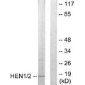 Western blot analysis of extracts from Jurkat cells, using HEN1/2 antibody.
