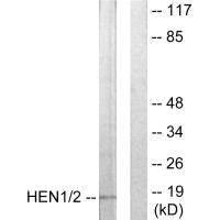 Western blot analysis of extracts from Jurkat cells, using HEN1/2 antibody.