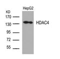 Western blot analysis of extracts from HepG2 cells using HDAC4(Ab-632) Antibody.