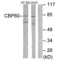 Western blot analysis of extracts from HT-29 cells and LOVO cells, using NCBP1 antibody.