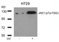 Western blot analysis of extracts from HT29 cells untreated or treated with UV using JAK1(Phospho-Tyr1022) Antibody.