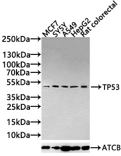 Western Blot Positive WB detected in: MCF7 whole cell lysate(20µg), SY5Y whole cell lysate(20µg), A549 whole cell lysate(20µg), HepG2 whole cell lysate(20µg), Rat colorectal tissue lysate(20µg) All lanes: TP53 antibody at 1:1000 Secondary Goat polyclonal to rabbit IgG at 1/20000 dilution Predicted band size: 44,38,39,40,34,35,30,24,25 kDa Observed band size: 53 kDa Exposure time: 120s