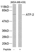 Western blot analysis of extracts from MDA-MB-435 cells using ATF2(Ab-112 or 94) Antibody and the same antibody preincubated with blocking peptide.