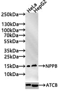 Western Blot Positive WB detected in: Hela whole cell lysate(30µg), HepG2 whole cell lysate(30µg) All lanes: NPPB antibody at 1:1000 Secondary Goat polyclonal to rabbit IgG at 1/20000 dilution Predicted band size: 15 kDa Observed band size: 15 kDa Exposure time：120s