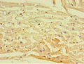 Immunohistochemistry of paraffin-embedded human heart tissue using CSB-PA07957A0Rb at dilution of 1:100