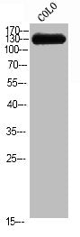 Western Blot analysis of COLO cells using CEP135 Polyclonal Antibody