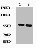 CTNNB1 Antibody – Figure 1 of 1