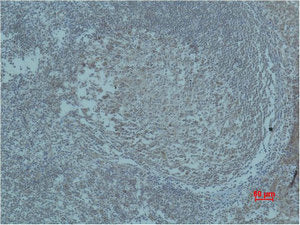 Immunohistochemical analysis of paraffin-embedded human Tonsil Tissue using HIF-1β Polyclonal Antibody.