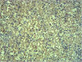 Immunohistochemical analysis of paraffin-embedded Mouse Liver Tissue using EPG5 Polyclonal Antibody.