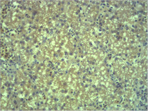 Immunohistochemical analysis of paraffin-embedded Mouse Liver Tissue using EPG5 Polyclonal Antibody.