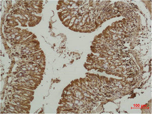 Immunohistochemical analysis of paraffin-embedded Mouse Colon Tissue using p53 Polyclonal Antibody.