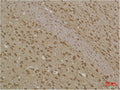 Immunohistochemical analysis of paraffin-embedded Rat BrainTissue using MAP LC3β Polyclonal Antibody.