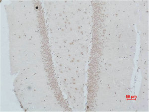 Immunohistochemical analysis of paraffin-embedded Rat Brain Tissue using NMBR Polyclonal Antibody.