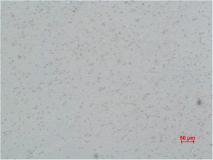 Immunohistochemical analysis of paraffin-embedded Rat Brain Tissue using L-type Ca++ CP γ5 Polyclonal Antibody.