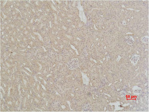 Immunohistochemical analysis of paraffin-embedded Mouse Kidney Tissue using SOD2 Polyclonal Antibody.