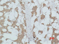 PIK3R1 Antibody – Figure 1 of 2