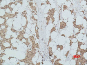 PIK3R1 Antibody – Figure 1 of 2