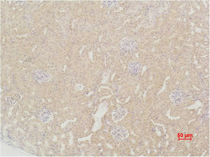 Immunohistochemical analysis of paraffin-embedded Mouse Kidney Tissue using SOD2 Polyclonal Antibody.