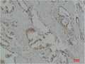 RPS6KB1 Antibody – Figure 1 of 2