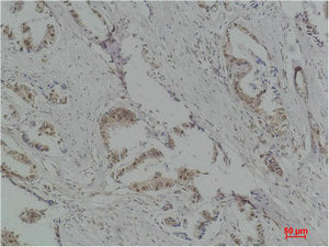 RPS6KB1 Antibody – Figure 1 of 2